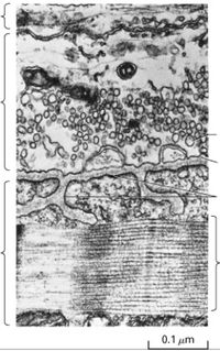 Figure 21.33 in the book